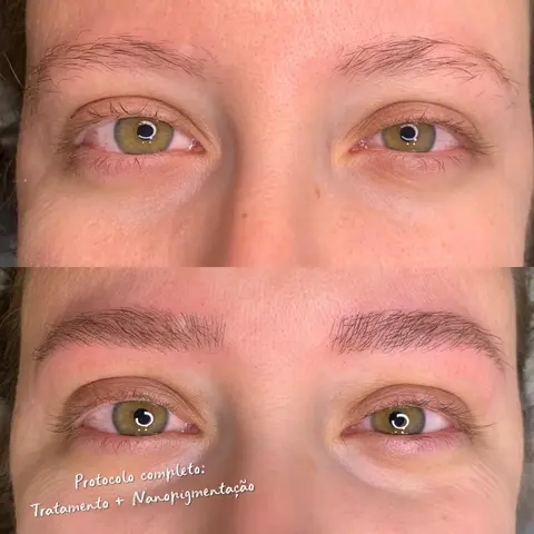 Protocolo Recupera — Aurea Beauty X Studio