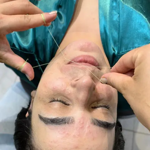 Epilação Facial — Resultado | Aurea Beauty X Studio Barretos