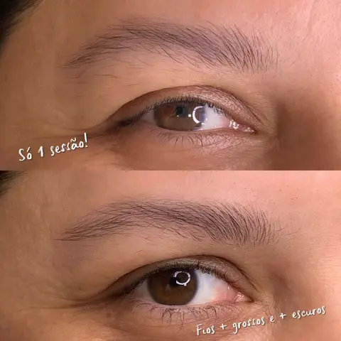 Protocolo Recupera — Resultado 2 | Aurea Beauty X Studio Barretos