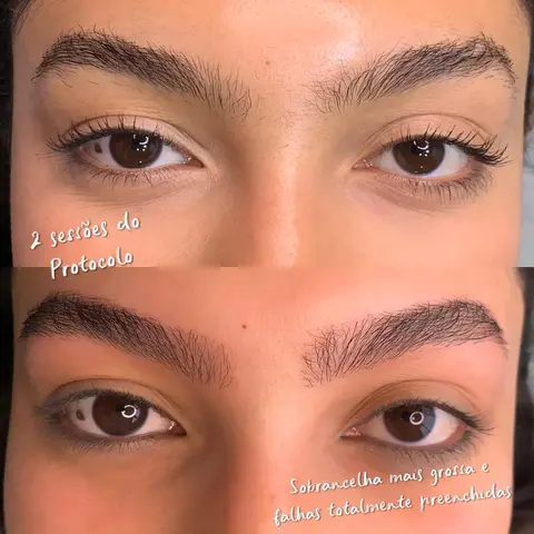 Protocolo Recupera — Resultado 3 | Aurea Beauty X Studio Barretos