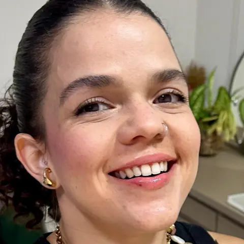 Regenera — Resultado 4 | Aurea Beauty X Studio Barretos